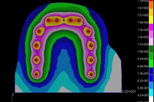 مقطع تغییرات دمائی در شبیه‌ساز انتقال حرارت سمبه کلاه ضدگلوله